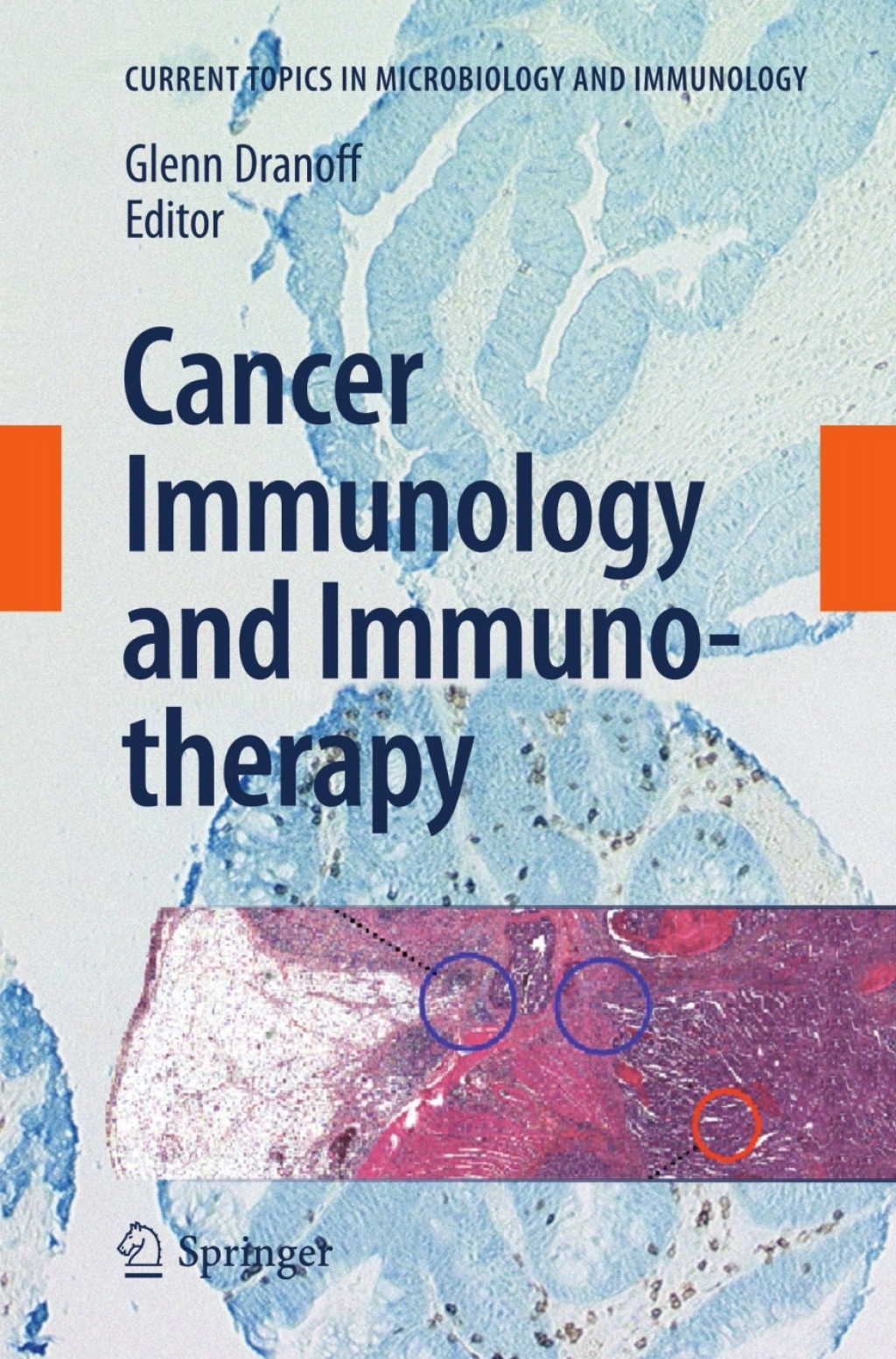Cancer Immunology and Immunotherapy 