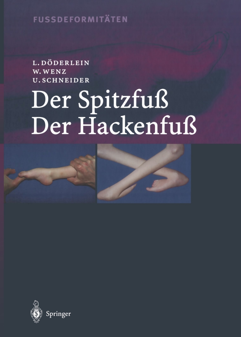 FussdeformitÃƒÂ¤ten Der Spitzfuss/Der Hackenfuss 