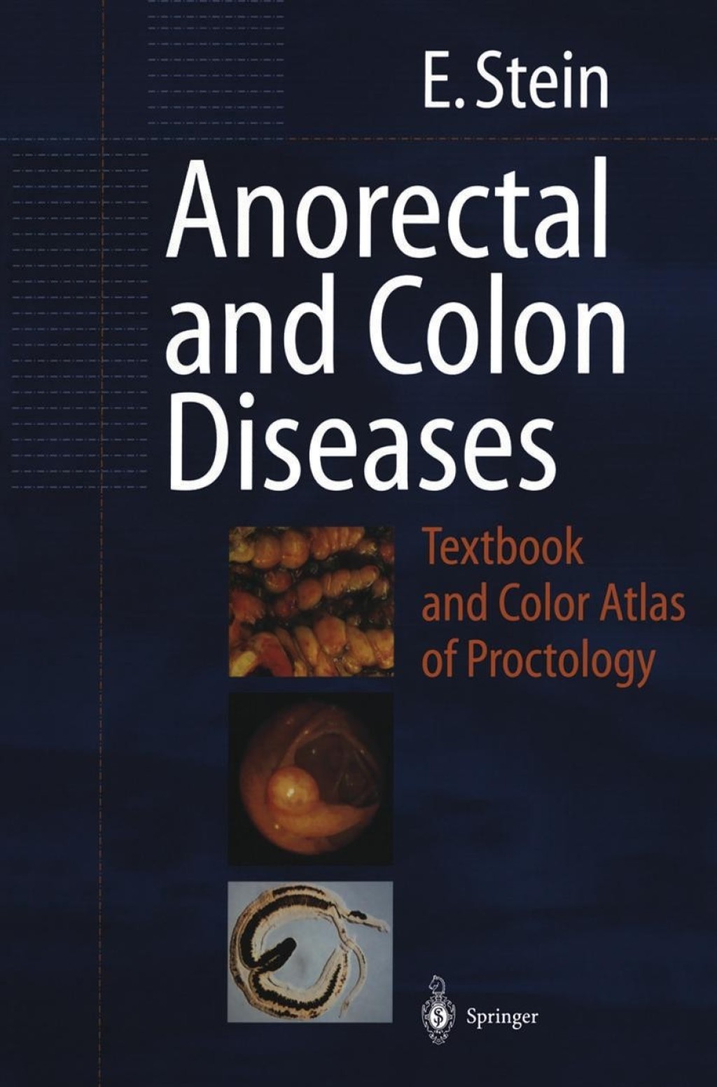 Anorectal and Colon Diseases Textbook and Color Atlas of Proctology 