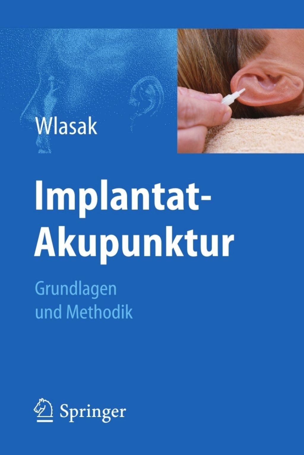 Implantat-Akupunktur Grundlagen und Methodik 