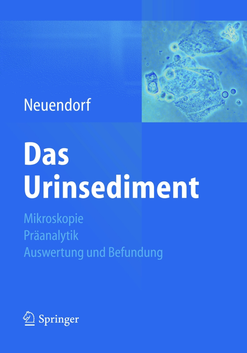 Das Urinsediment Mikroskopie-PrÃƒÂ¤analytik-Auswertung und Befundung 