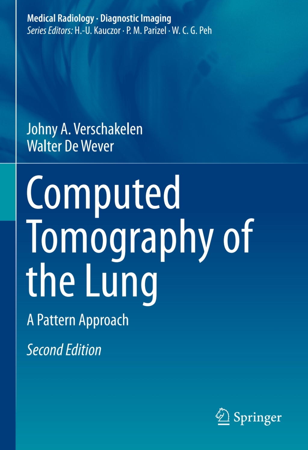 Computed Tomography of the Lung A Pattern Approach 2nd Edition