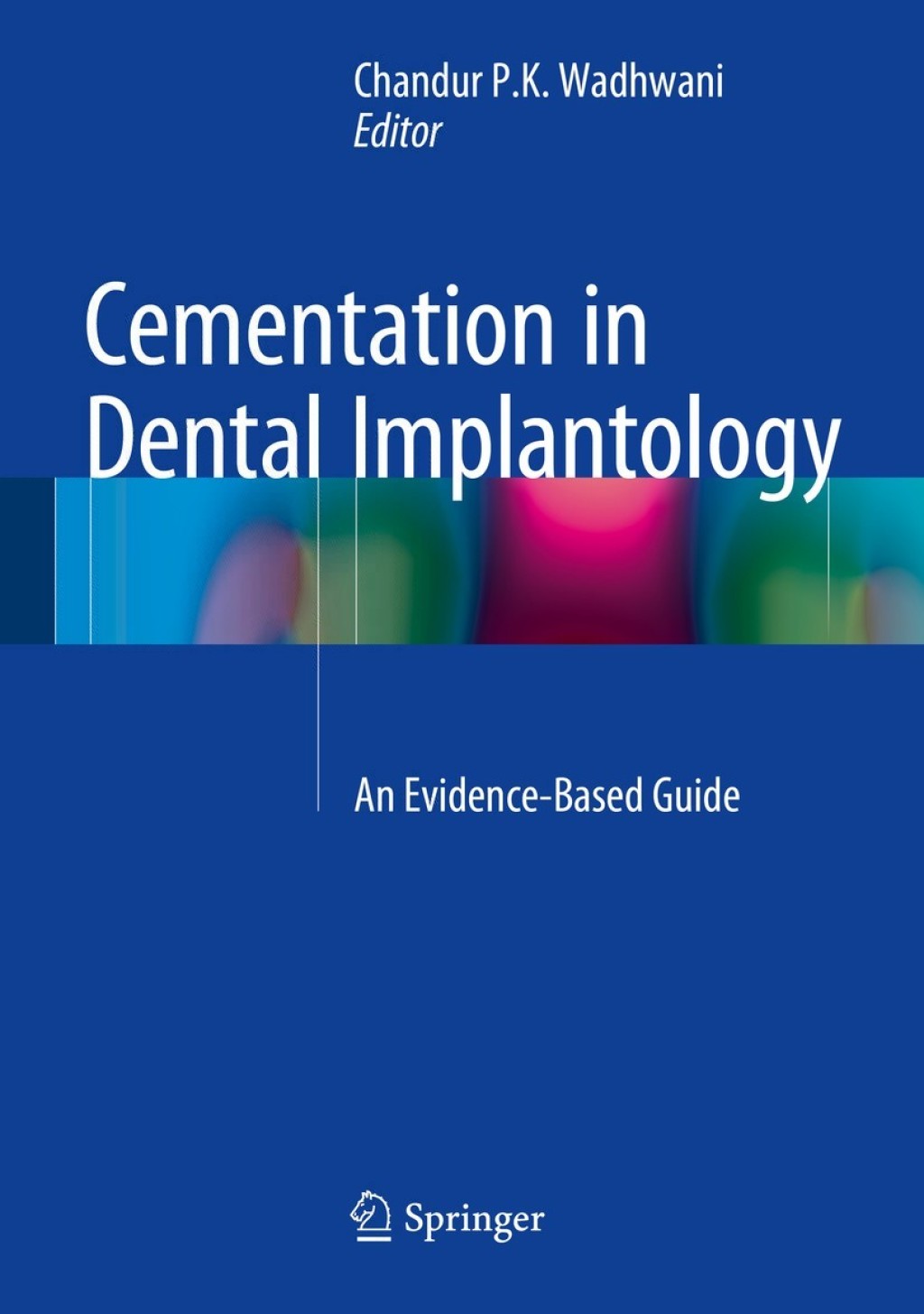 Cementation in Dental Implantology An Evidence-Based Guide 