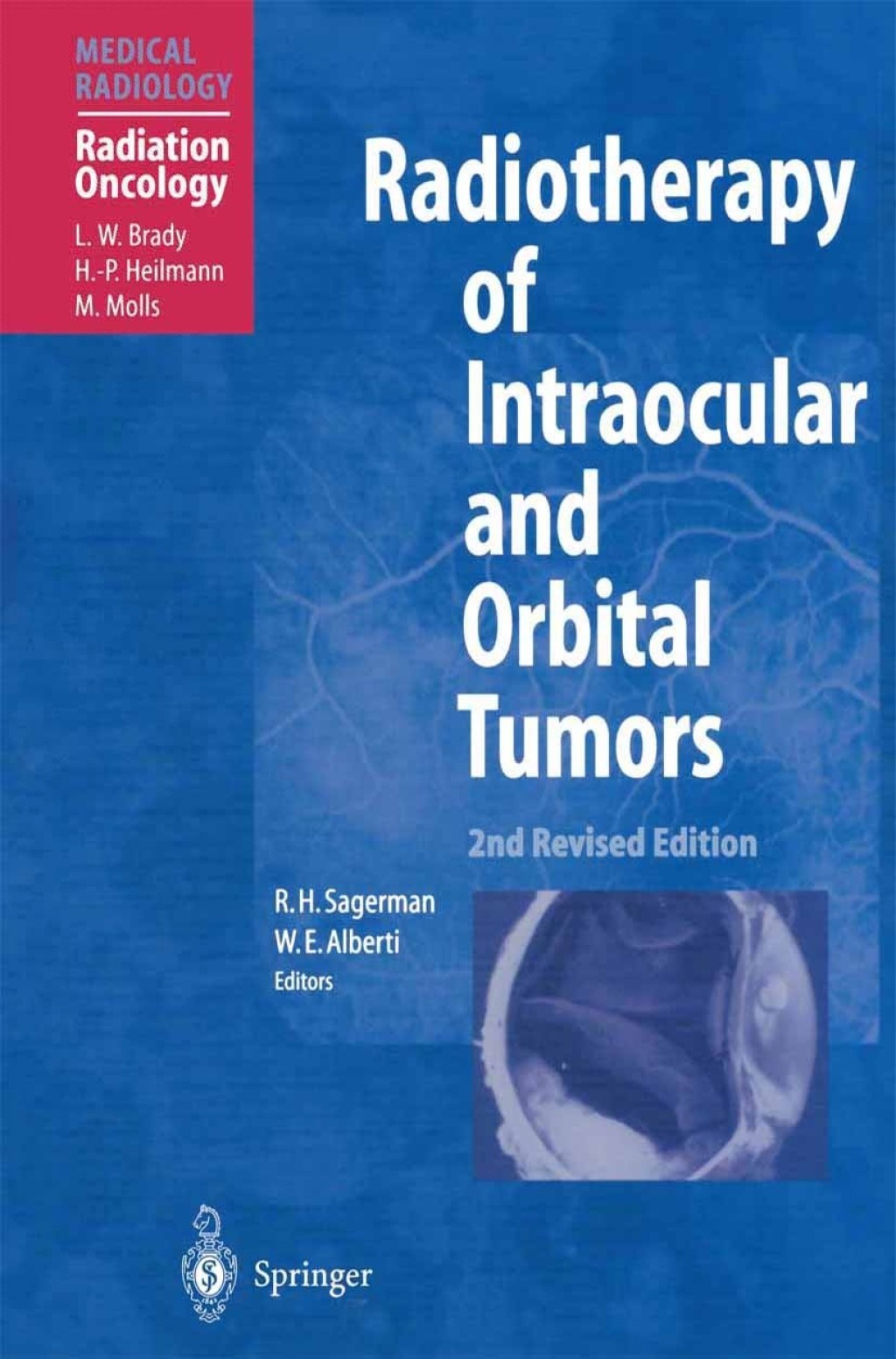 Radiotherapy of Intraocular and Orbital Tumors 2nd Edition