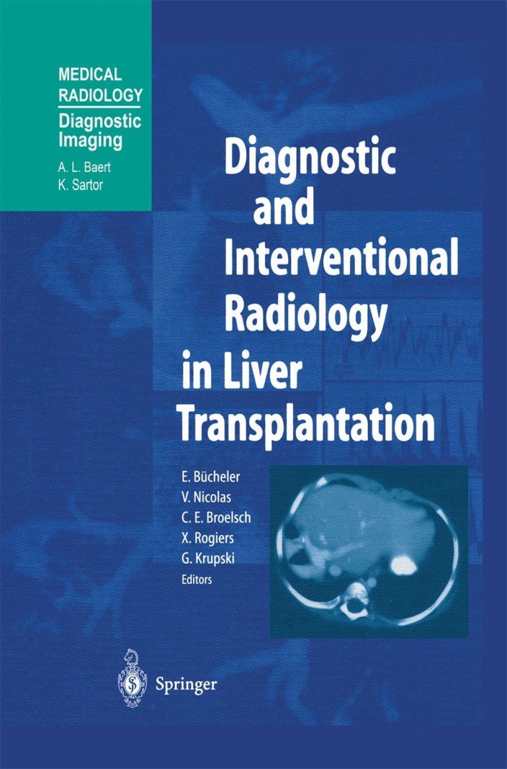 Diagnostic and Interventional Radiology in Liver Transplantation 1st Edition