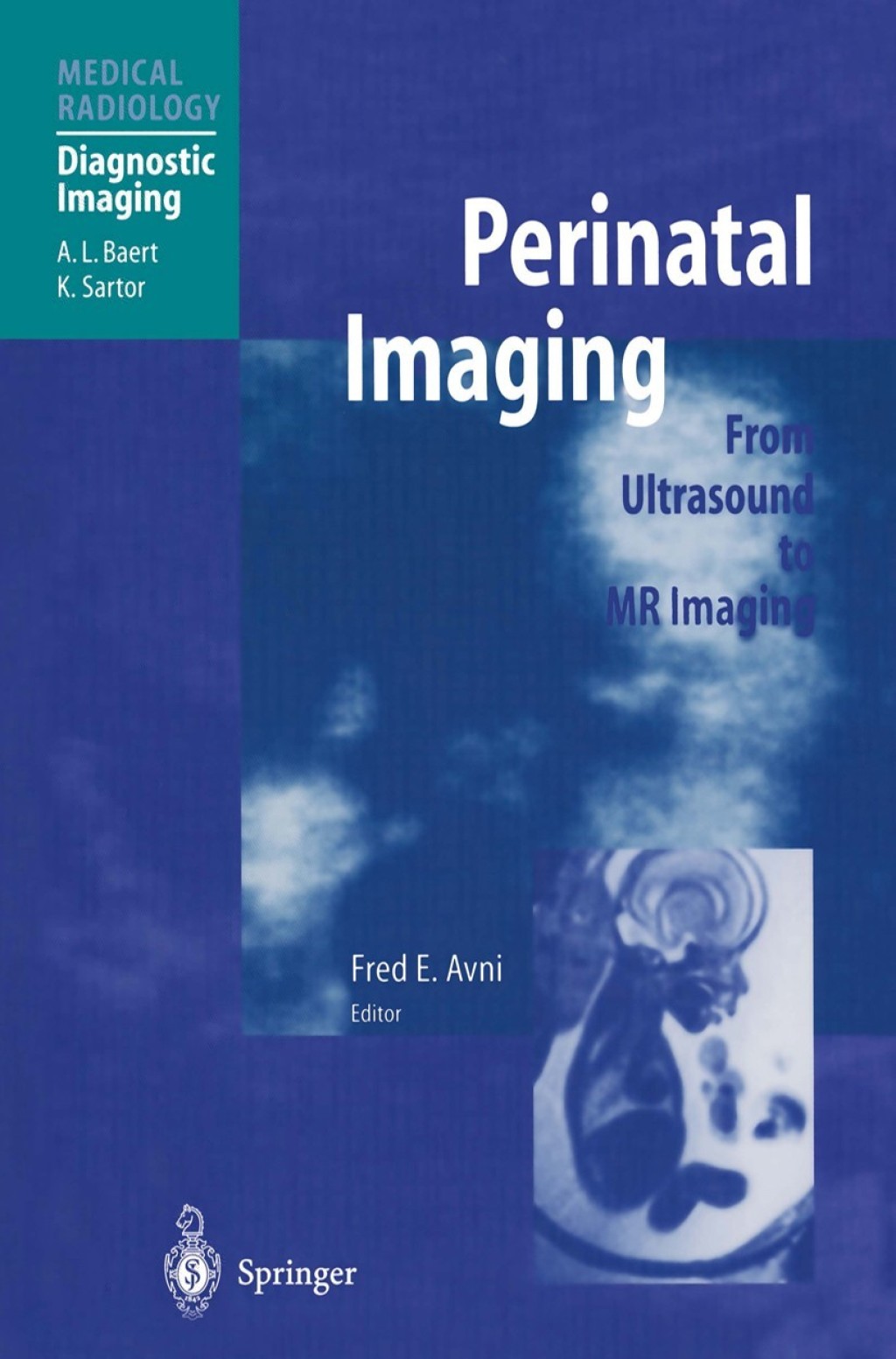 Perinatal Imaging From Ultrasound to MR Imaging 1st Edition