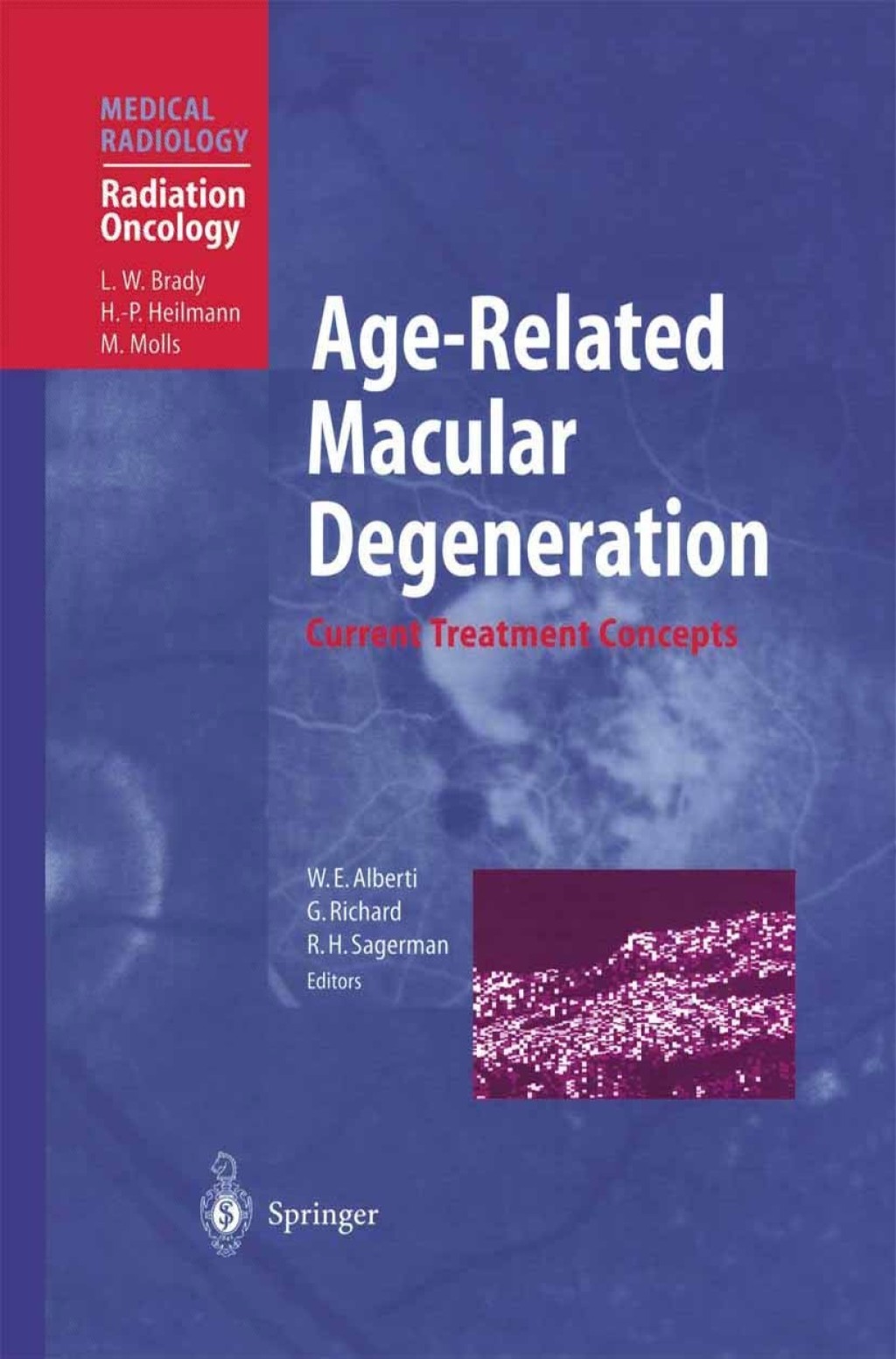 Age-Related Macular Degeneration Current Treatment Concepts 1st Edition