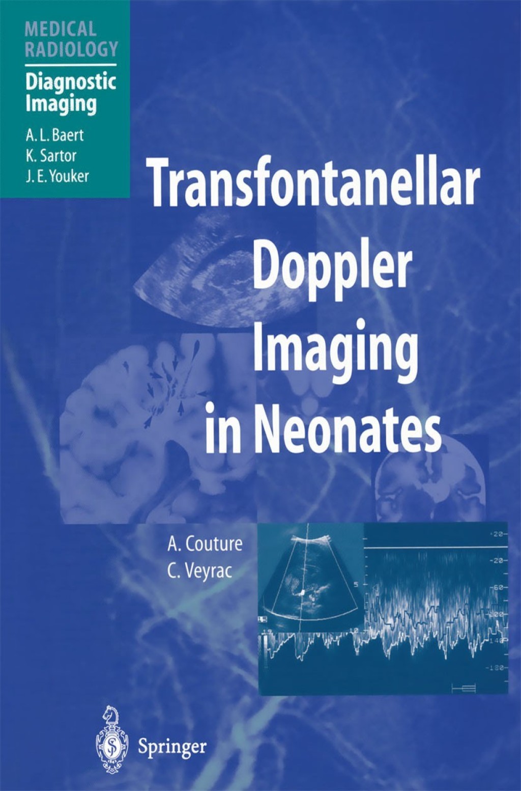 Transfontanellar Doppler Imaging in Neonates 