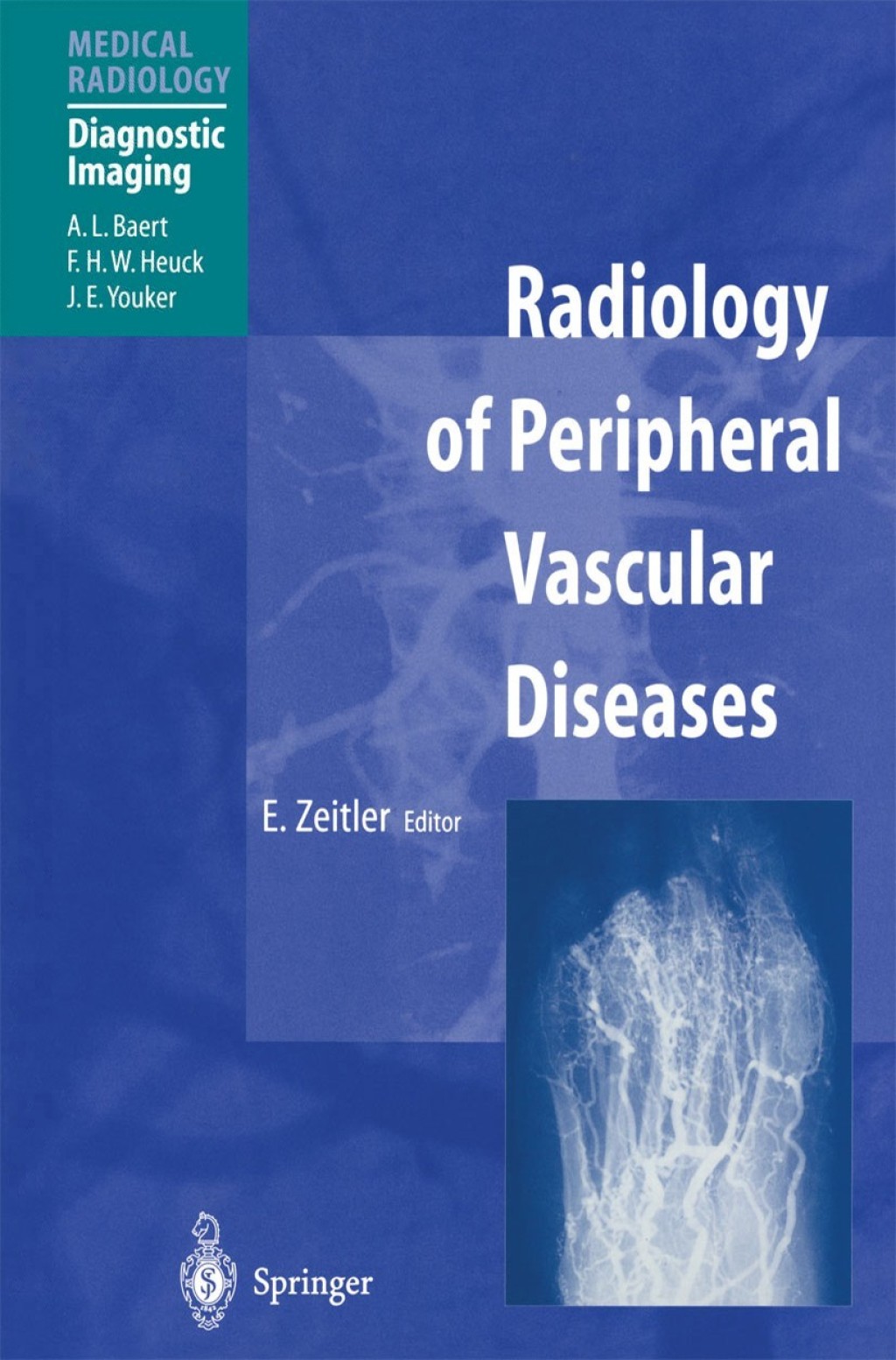 Radiology of Peripheral Vascular Diseases 1st Edition