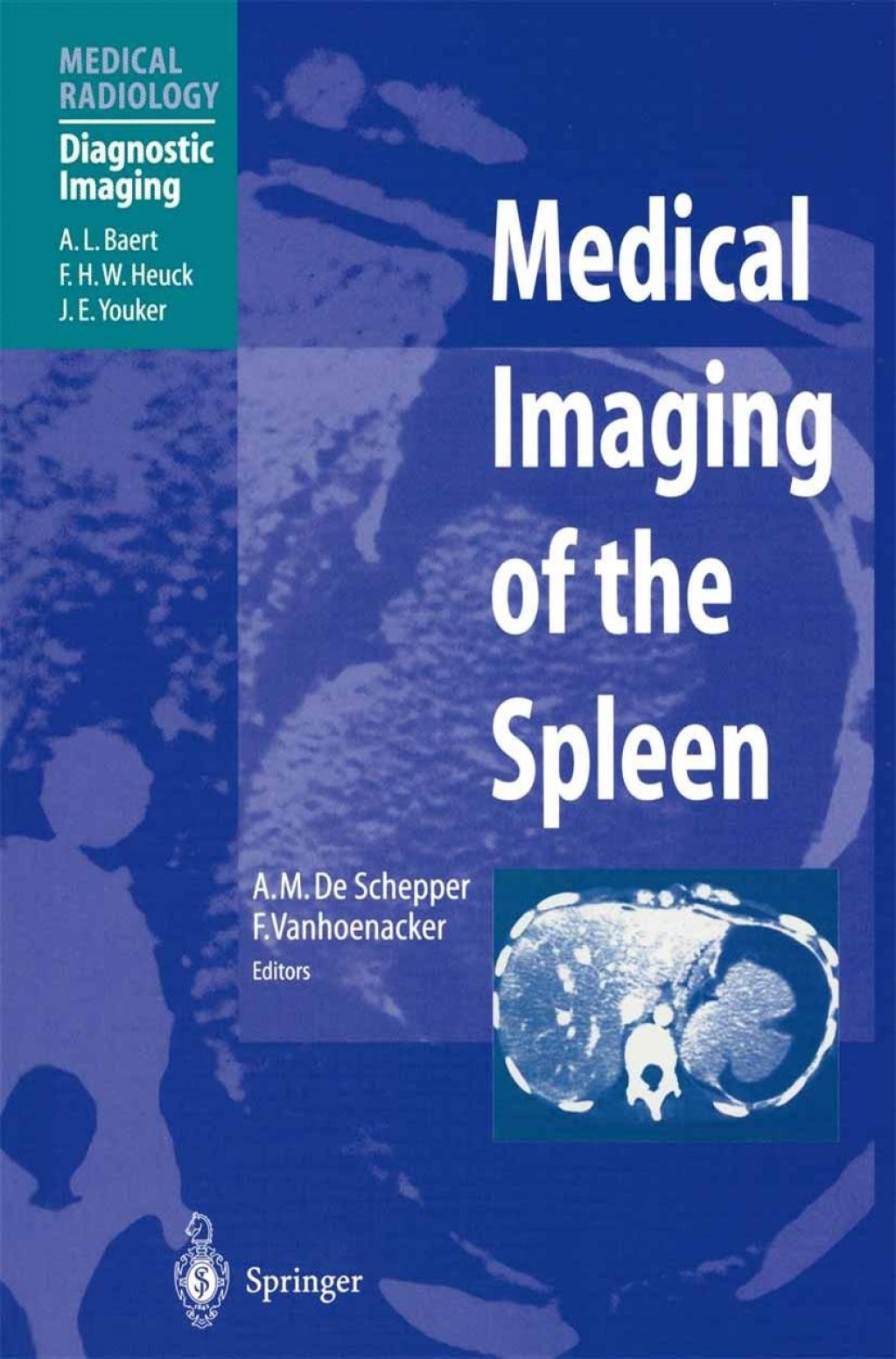 Medical Imaging of the Spleen 1st Edition