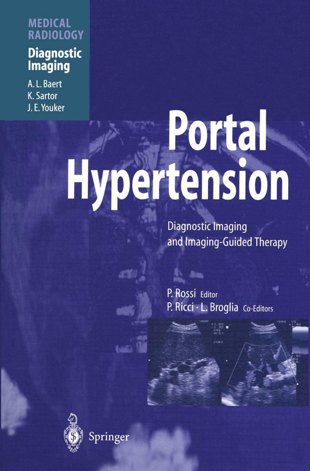 Portal Hypertension Diagnostic Imaging and Imaging-Guided Therapy 1st Edition