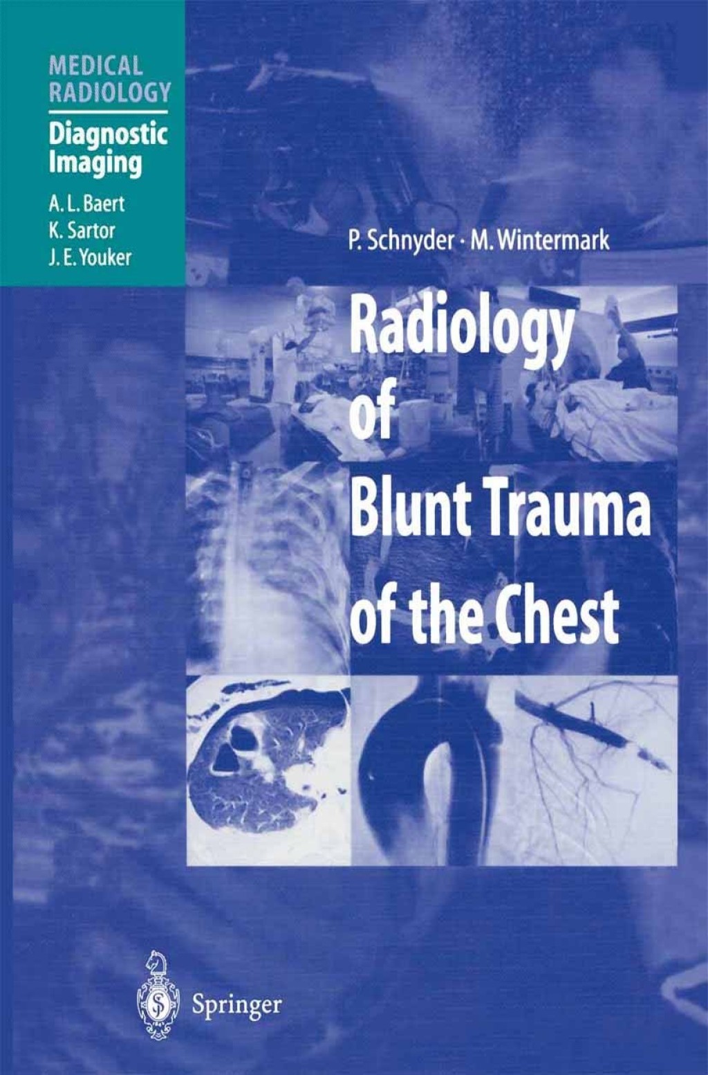 Radiology of Blunt Trauma of the Chest 