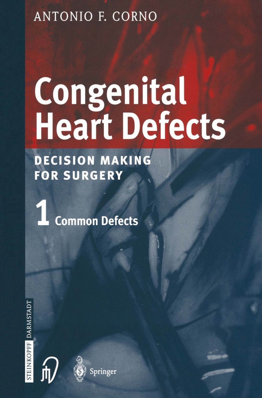 Congenital Heart Defects Decision Making for Cardiac Surgery Volume 1 Common Defects 