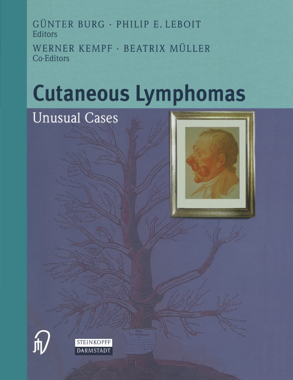 Cutaneous Lymphomas Unusual Cases 1st Edition
