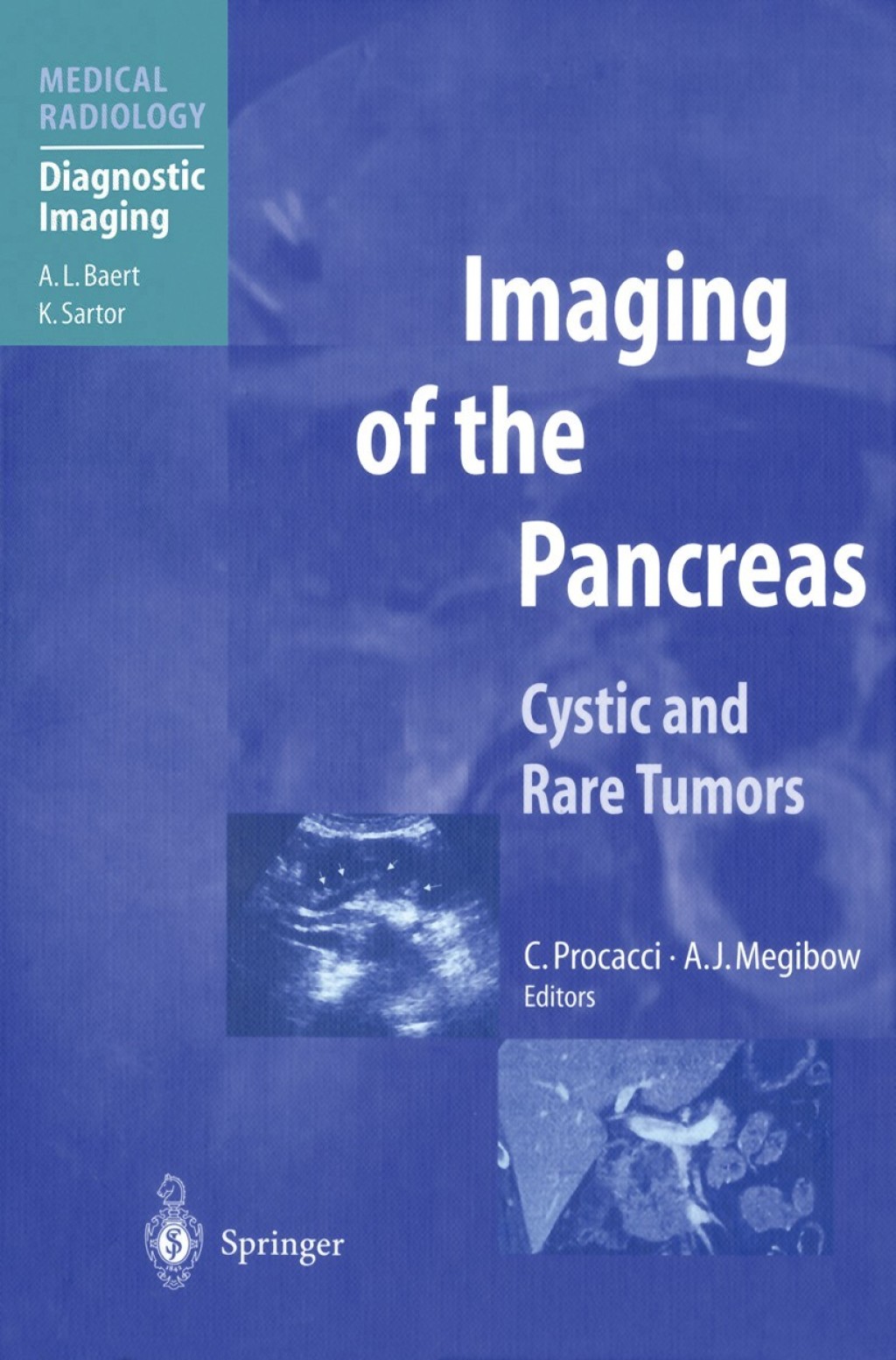 Imaging of the Pancreas Cystic and Rare Tumors 1st Edition