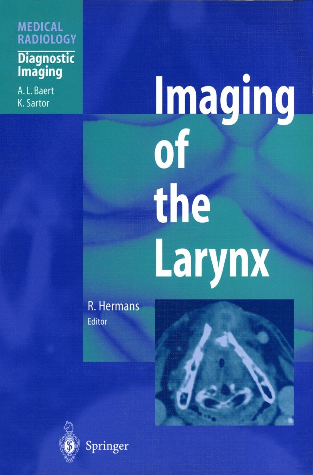 Imaging of the Larynx 1st Edition