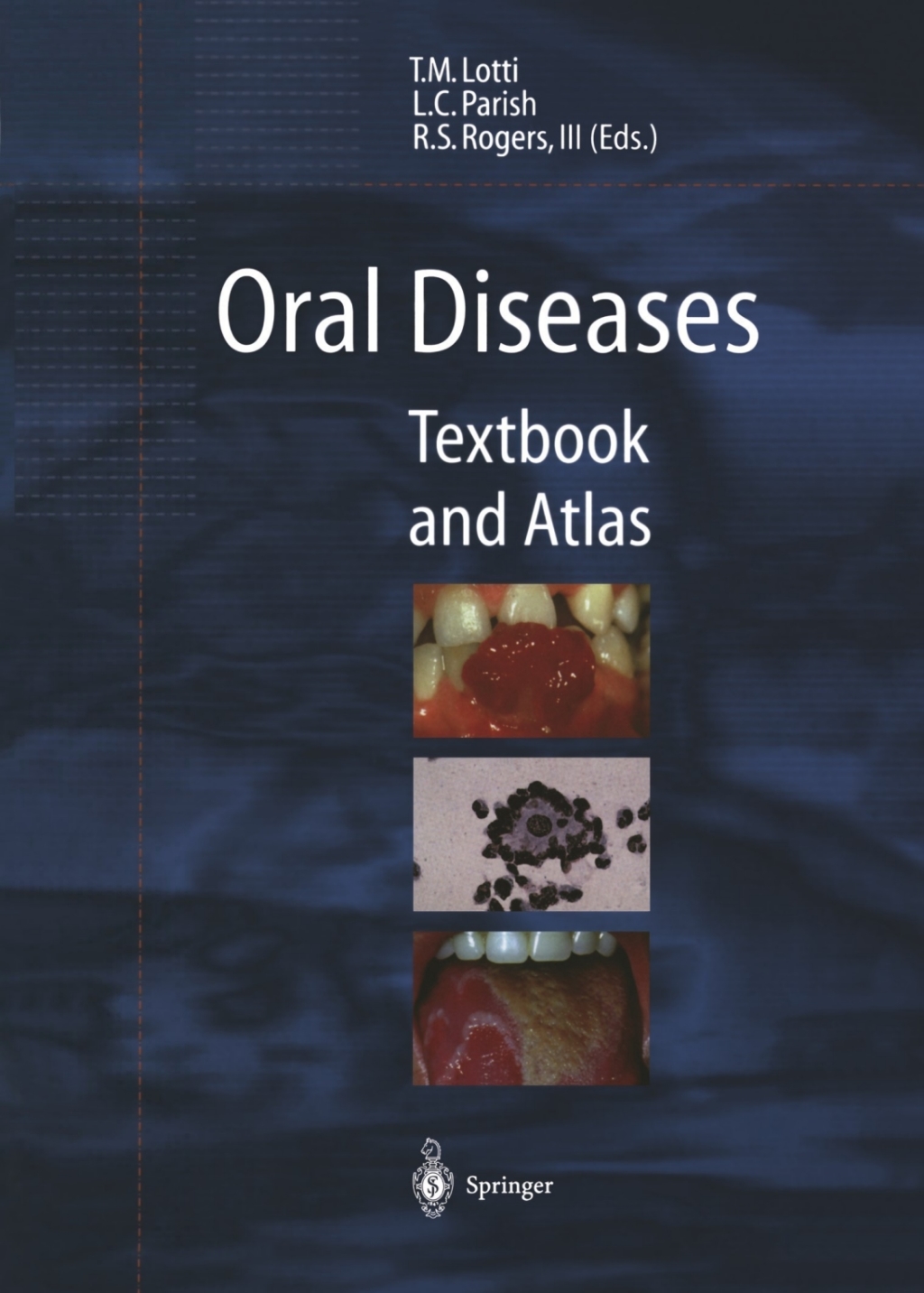 Oral Diseases Textbook and Atlas 1st Edition