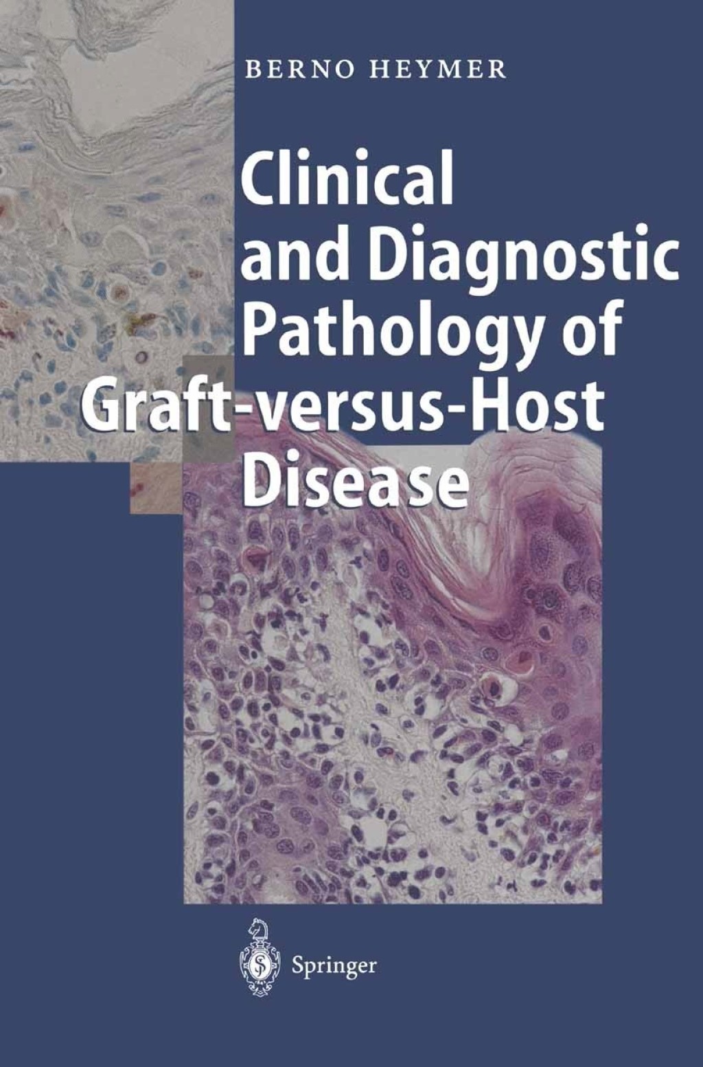 Clinical and Diagnostic Pathology of Graft-versus-Host Disease 