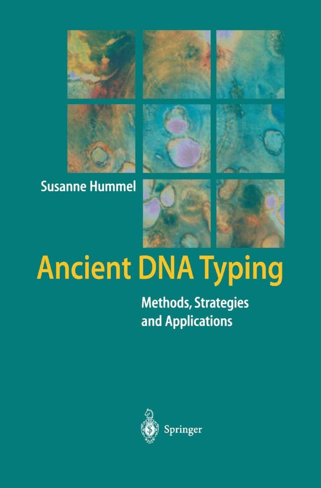 Ancient DNA Typing Methods, Strategies and Applications 