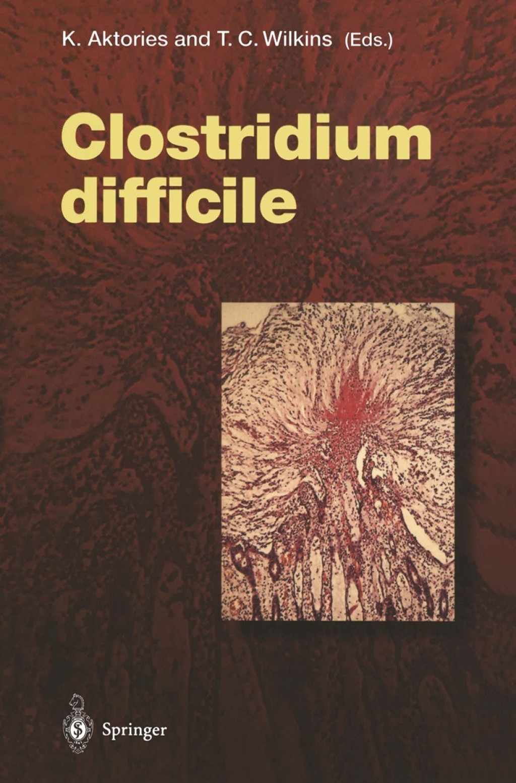 Clostridium difficile 1st Edition