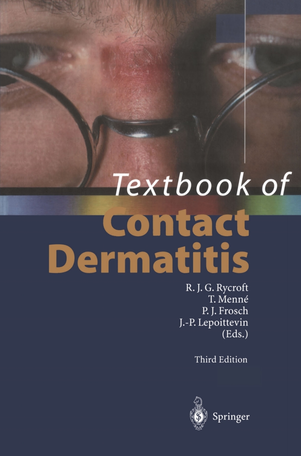Textbook of Contact Dermatitis 3rd Edition