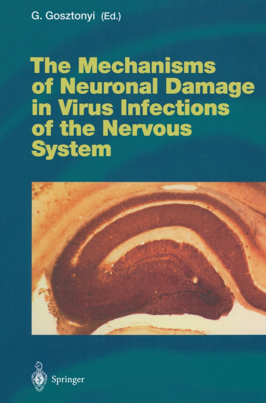 The Mechanisms of Neuronal Damage in Virus Infections of the Nervous System 1st Edition