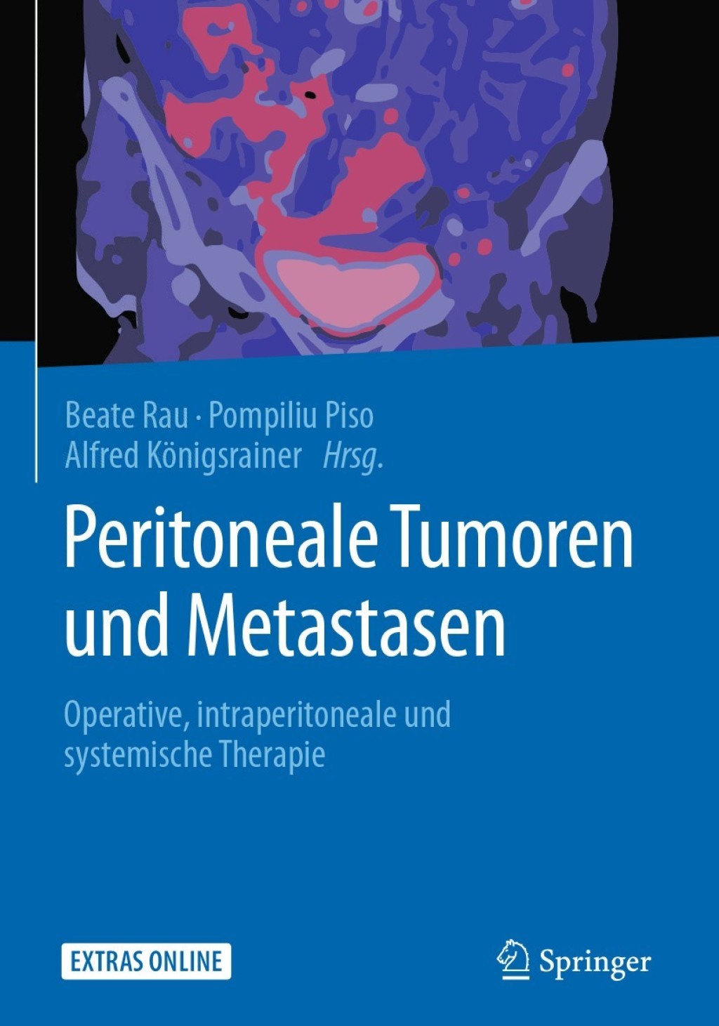 Peritoneale Tumoren und Metastasen Operative, intraperitoneale und systemische Therapie 