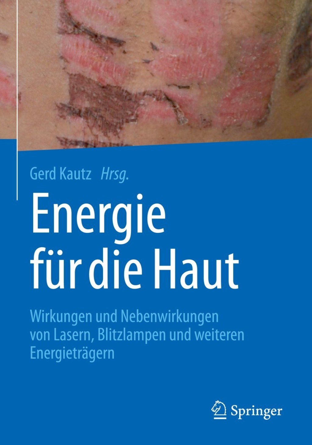 Energie fÃƒÂ¼r die Haut Wirkungen und Nebenwirkungen von Lasern, Blitzlampen und weiteren EnergietrÃƒÂ¤gern 