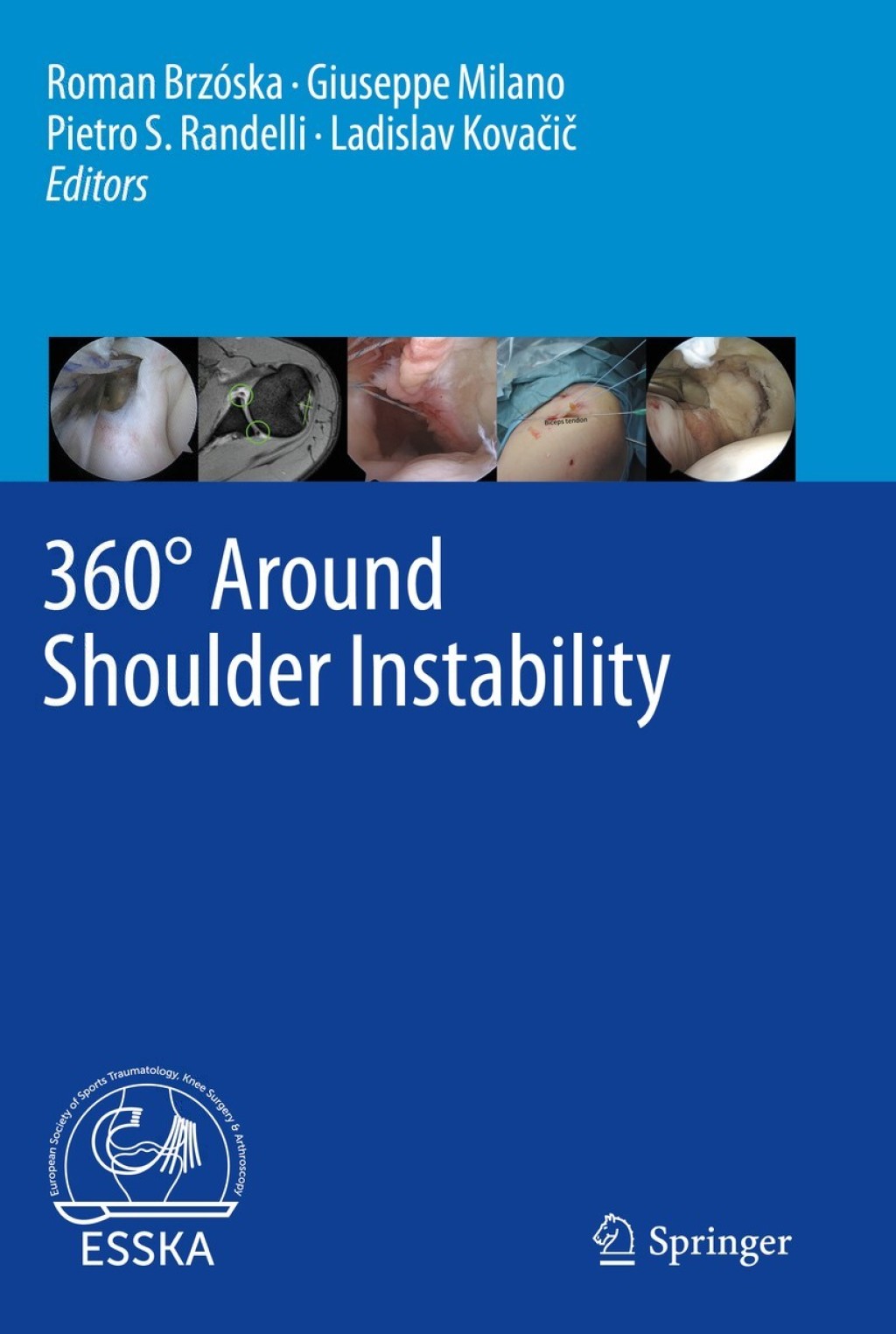 360Ã‚Â° Around Shoulder Instability 1st Edition