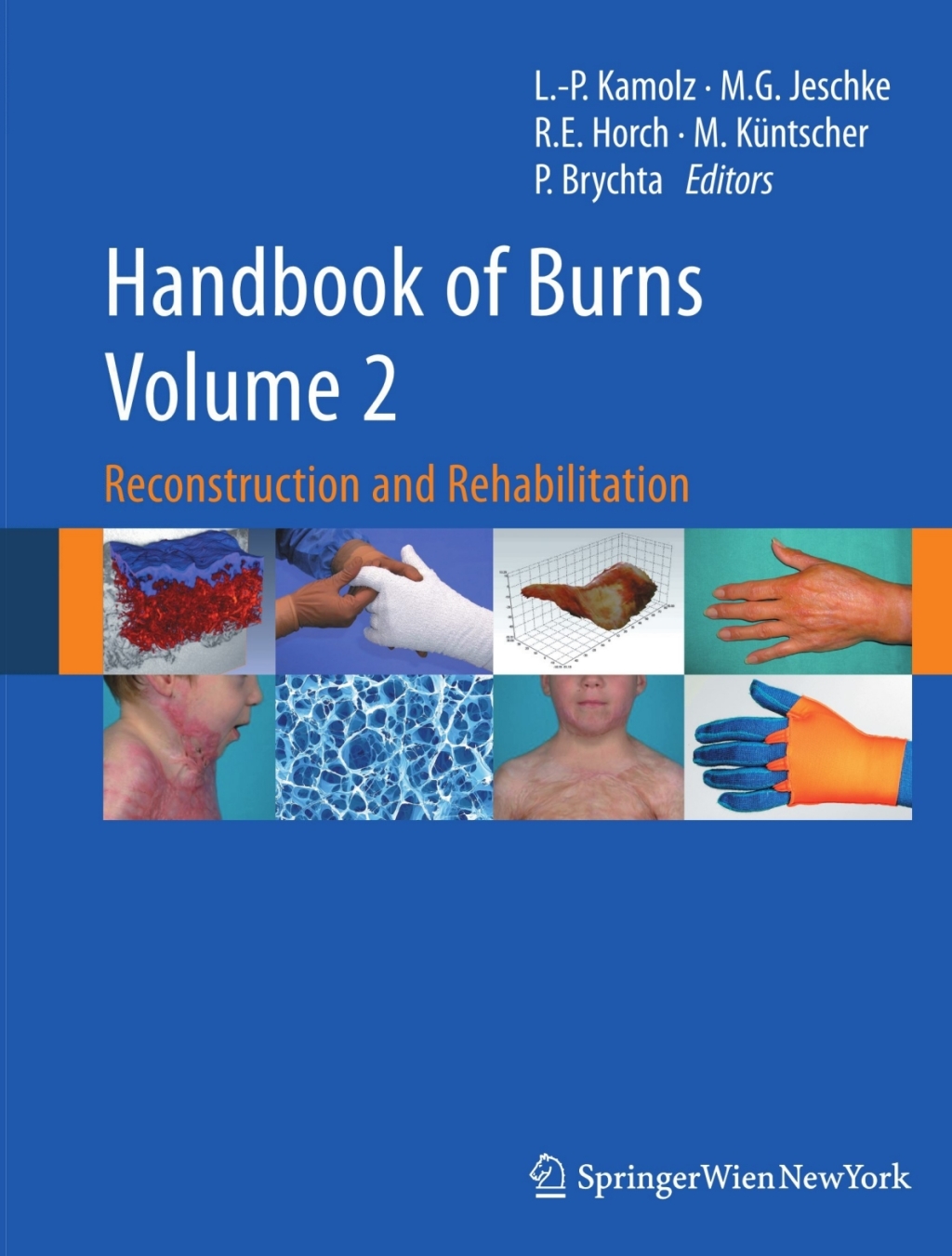 Handbook of Burns Volume 2 Reconstruction and Rehabilitation 
