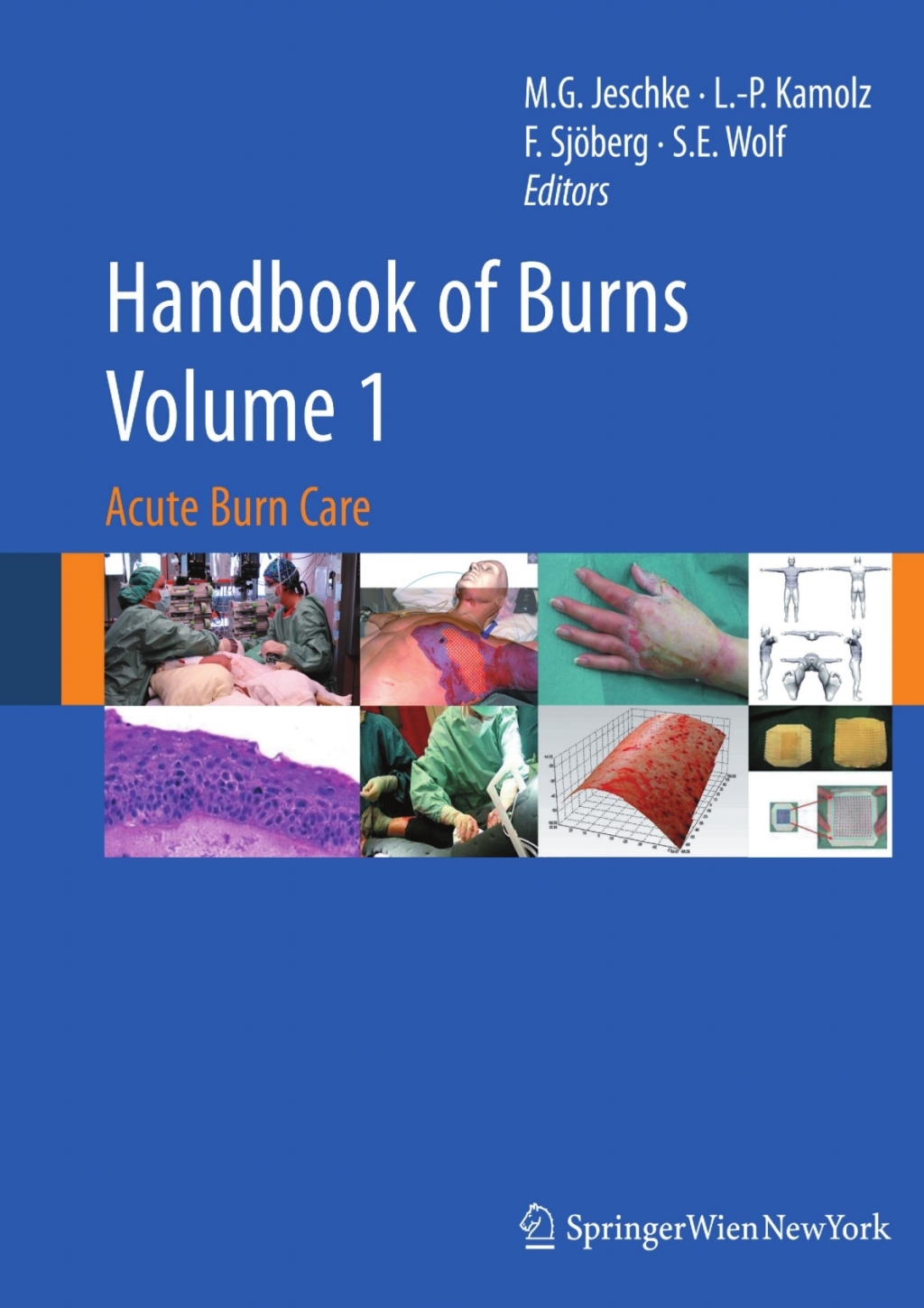 Handbook of Burns Volume 1 Acute Burn Care 
