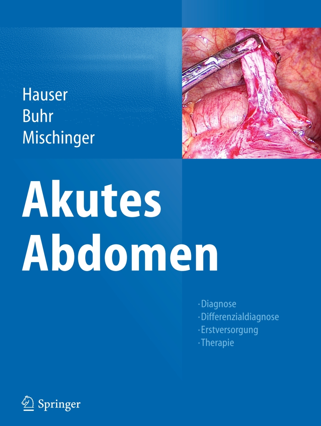 Akutes Abdomen Diagnose - Differenzialdiagnose - Erstversorgung - Therapie 