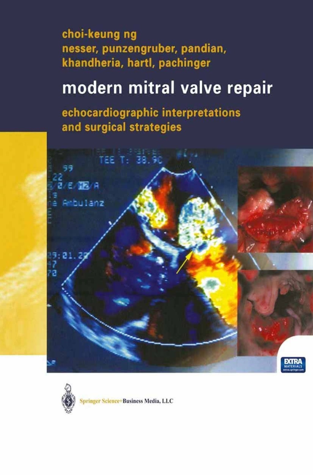 Modern Mitral Valve Repair Echocardiographic Interpretations and Surgical Strategies 