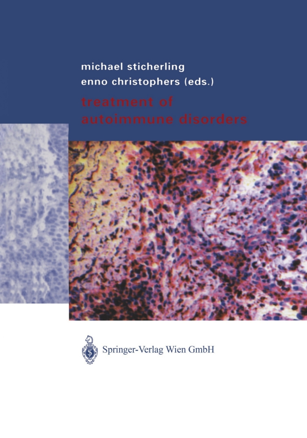 Treatment of Autoimmune Disorders 1st Edition