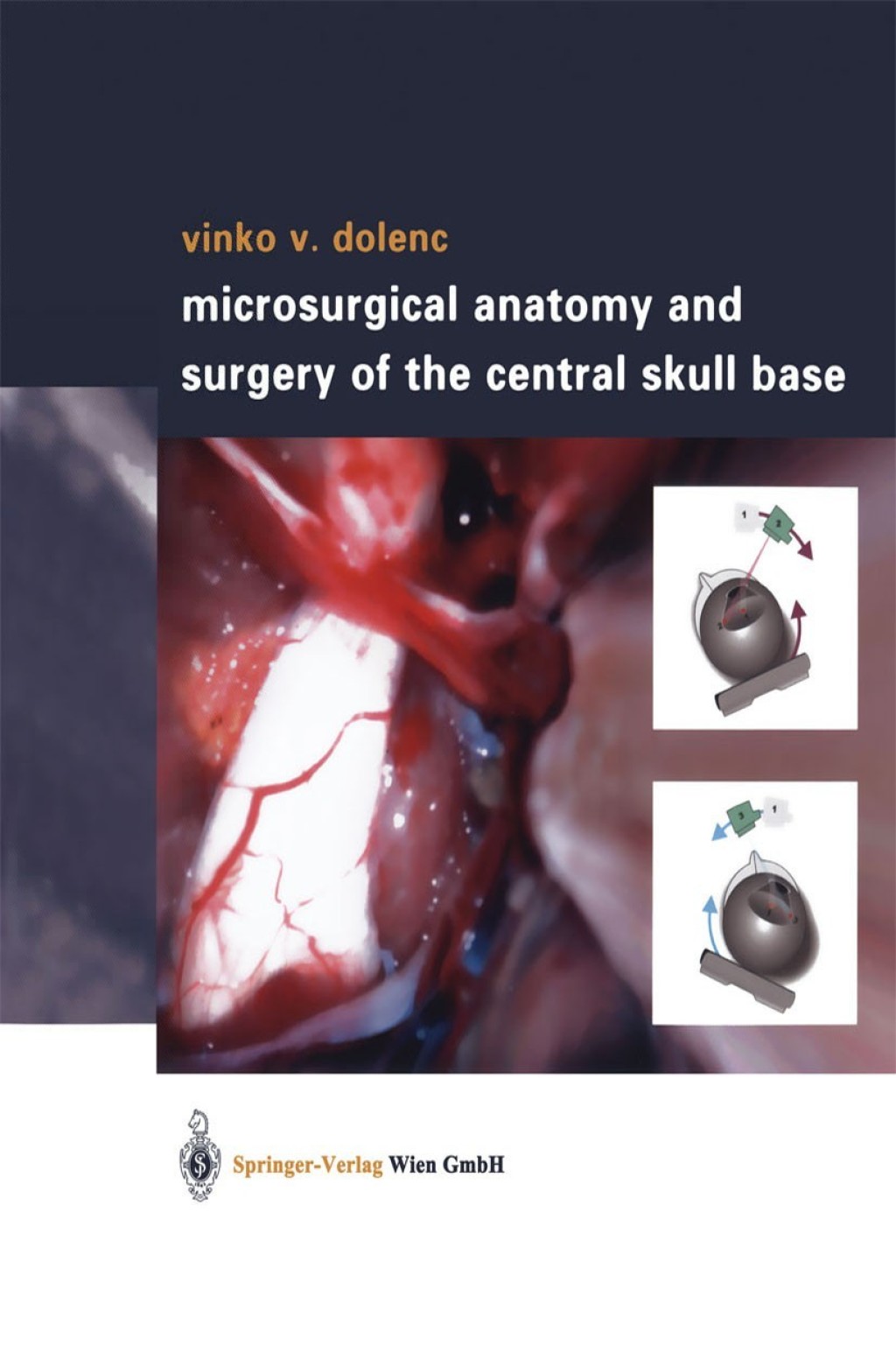 Microsurgical Anatomy and Surgery of the Central Skull Base 