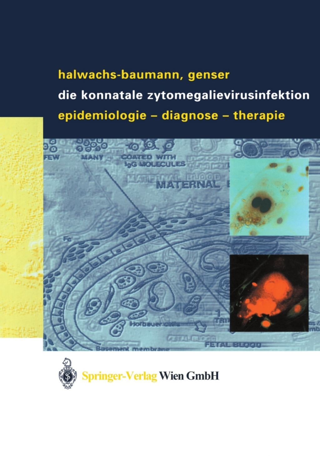Die konnatale Zytomegalievirusinfektion Epidemiologie - Diagnose - Therapie 