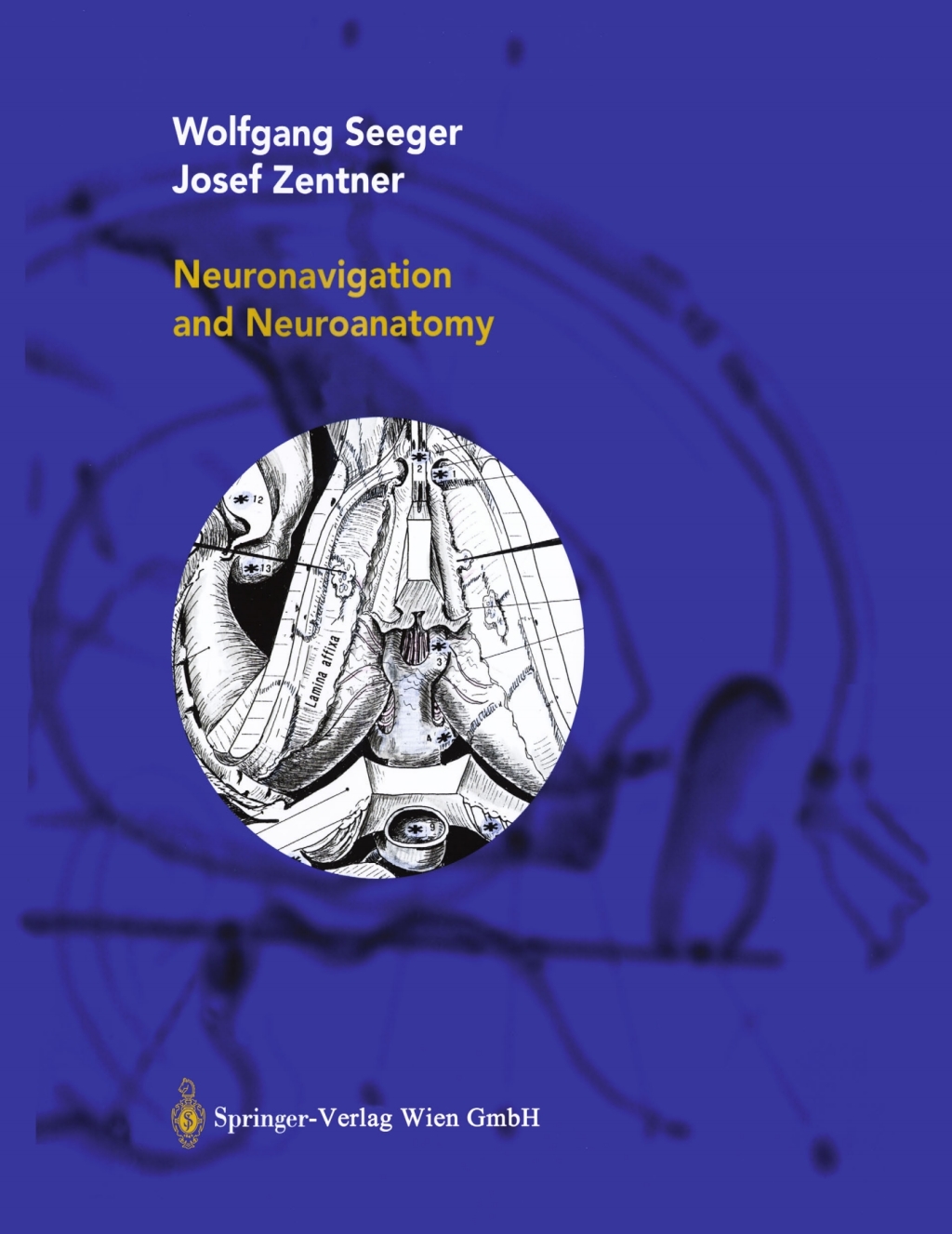 Neuronavigation and Neuroanatomy 