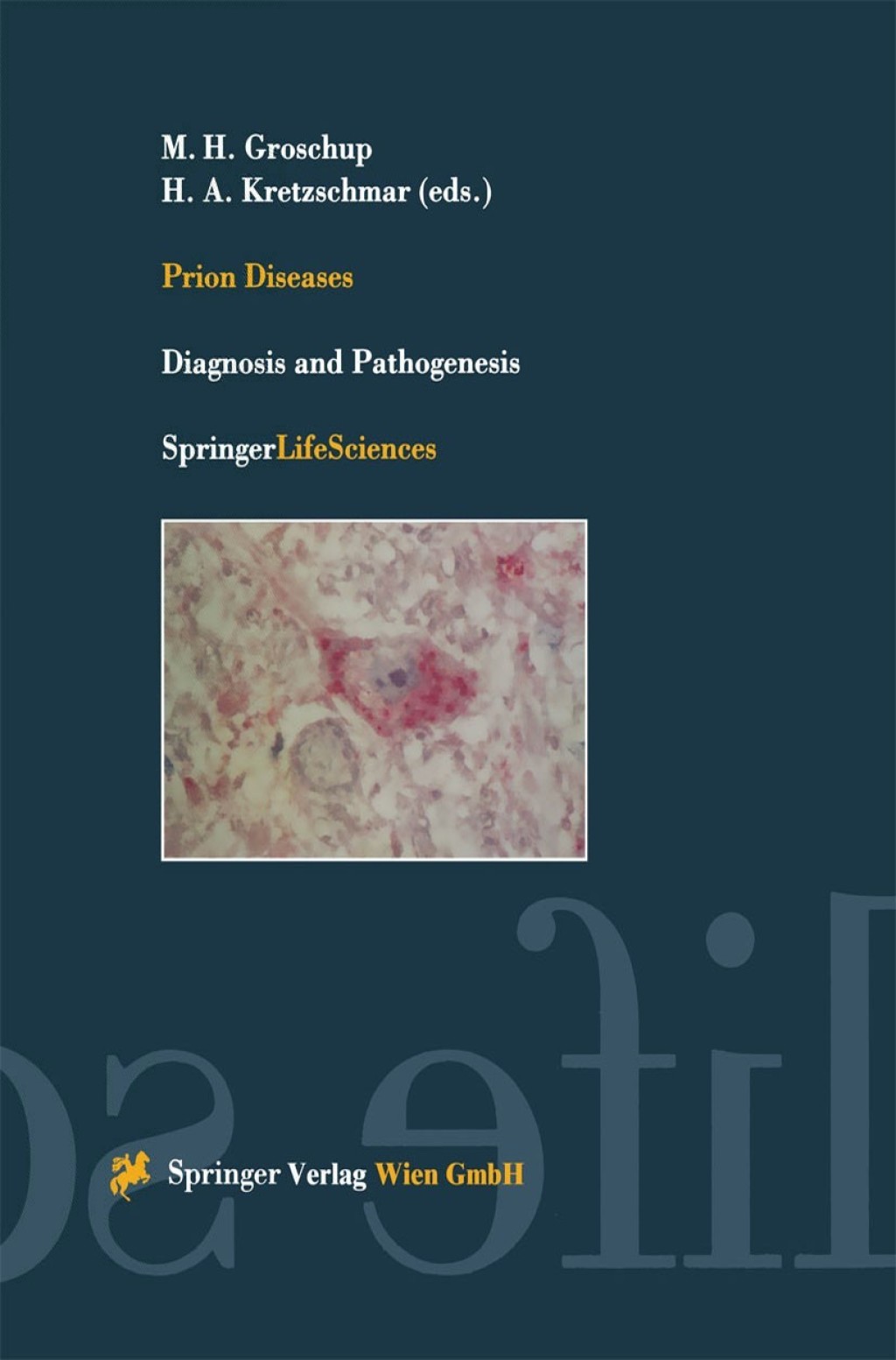 Prion Diseases Diagnosis and Pathogenesis 1st Edition