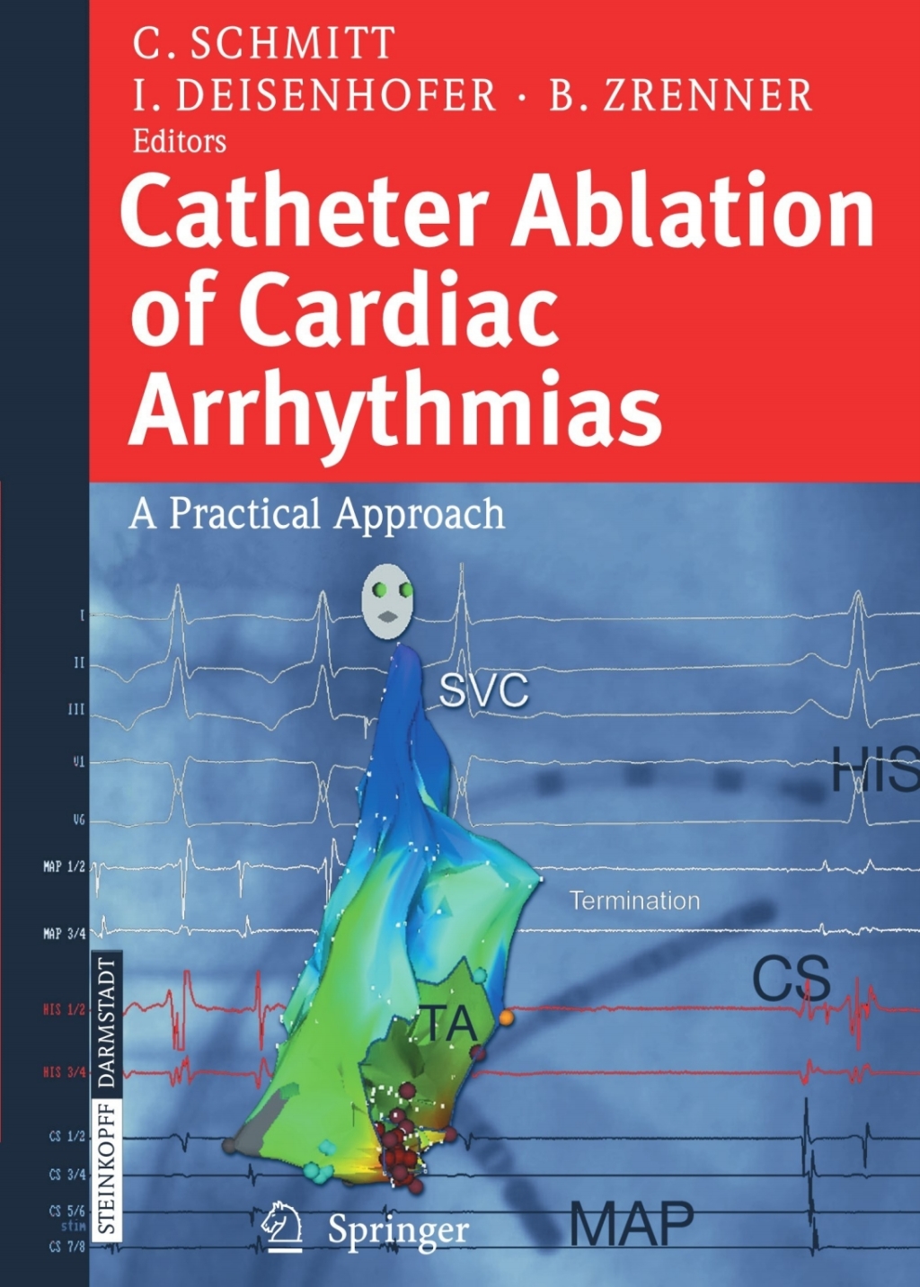 Catheter Ablation of Cardiac Arrhythmias A Practical Approach 1st Edition