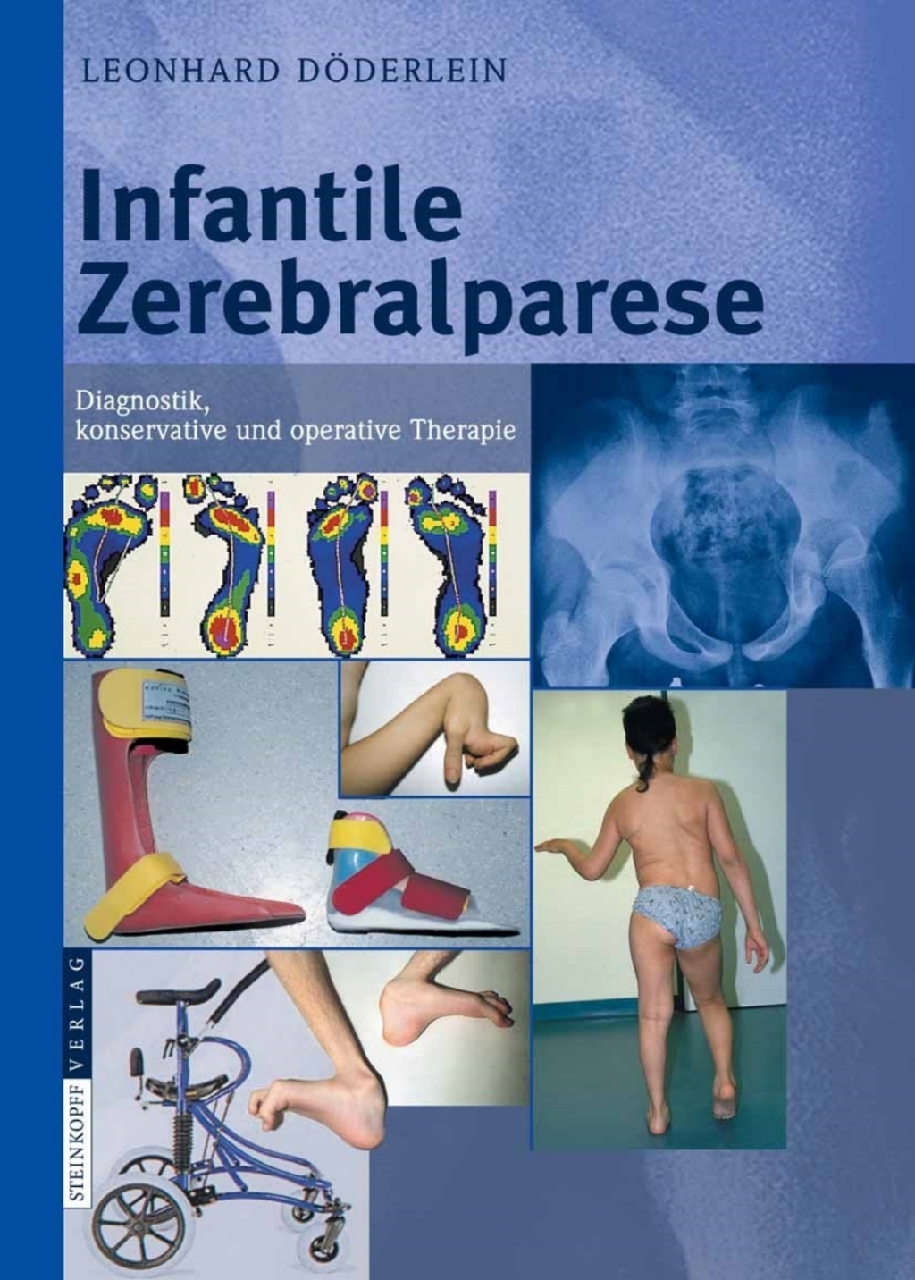 Infantile Zerebralparese Diagnostik, konservative und operative Therapie 