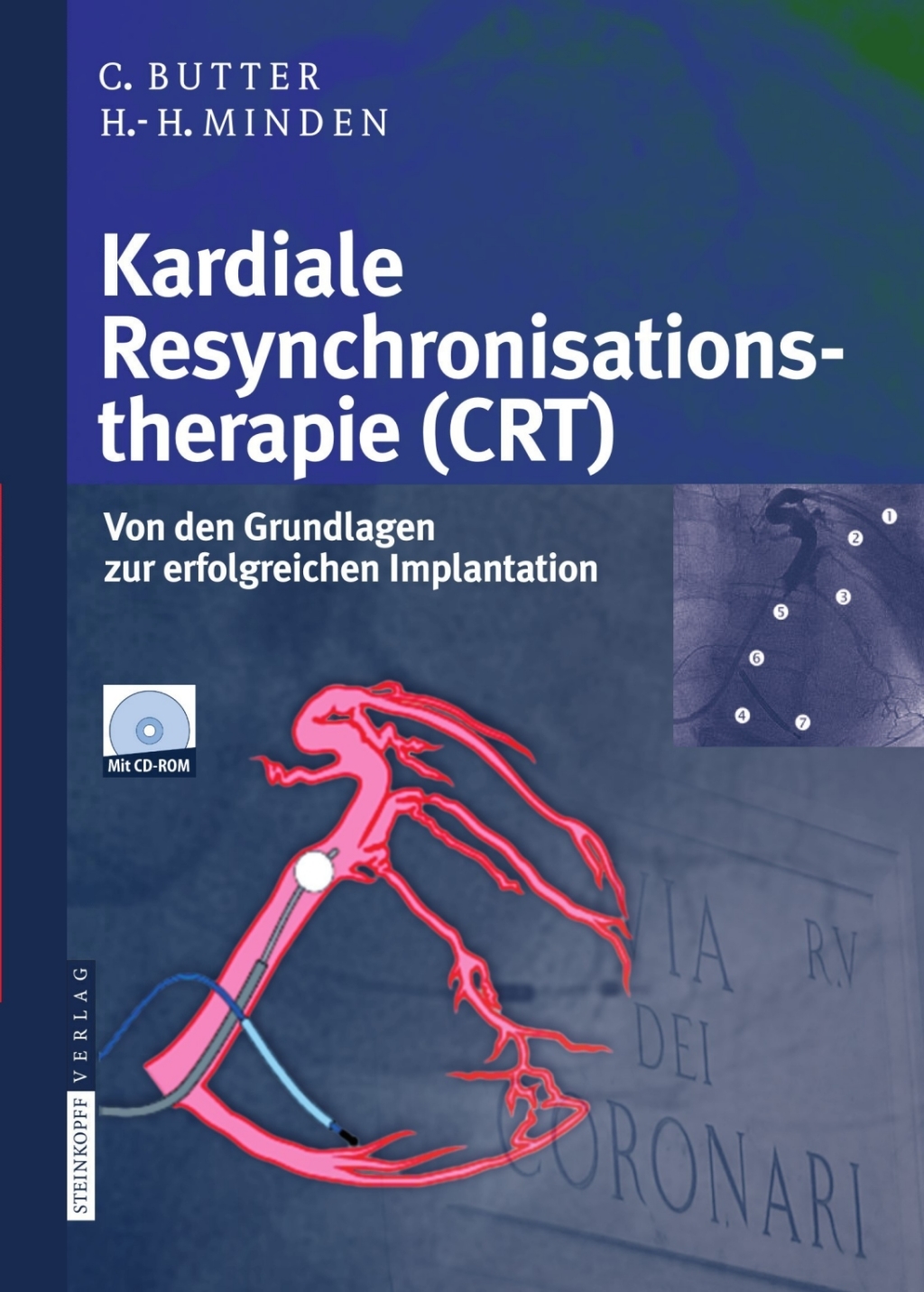 Kardiale Resynchronisationstherapie (CRT) Von den Grundlagen zur erfolgreichen Implantation 