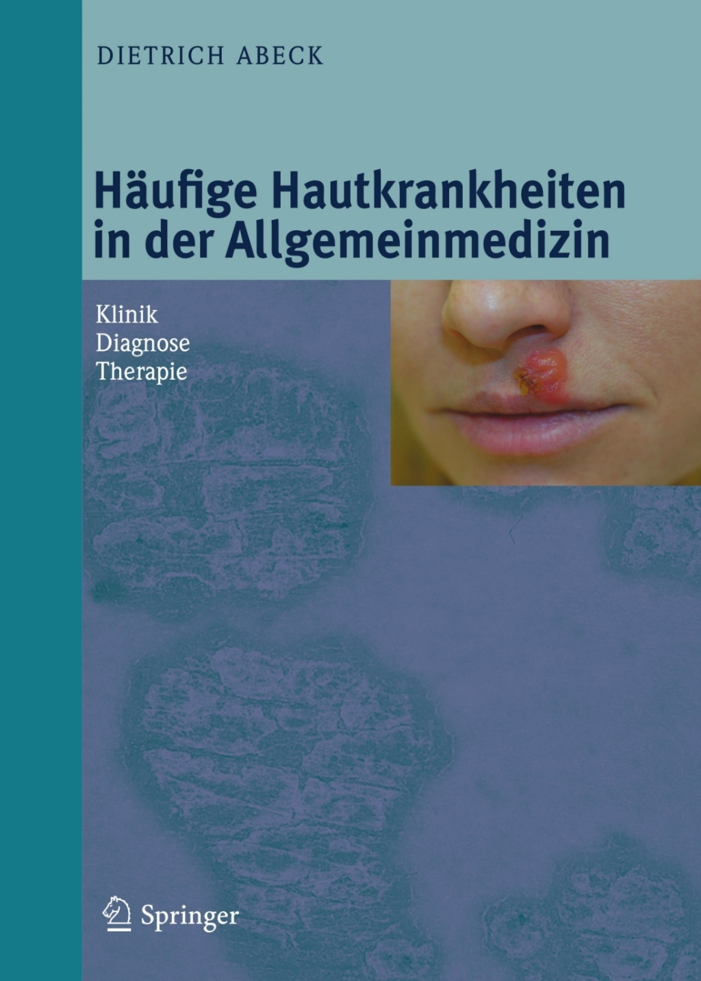HÃƒÂ¤ufige Hautkrankheiten in der Allgemeinmedizin Klinik, Diagnose, Therapie 