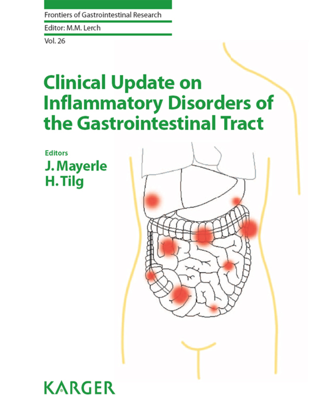 Clinical Update on Inflammatory Disorders of the Gastrointestinal Tract 1st Edition