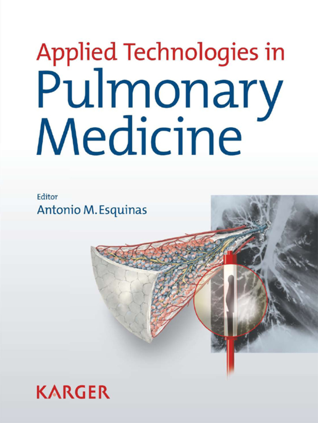 Applied Technologies in Pulmonary Medicine 