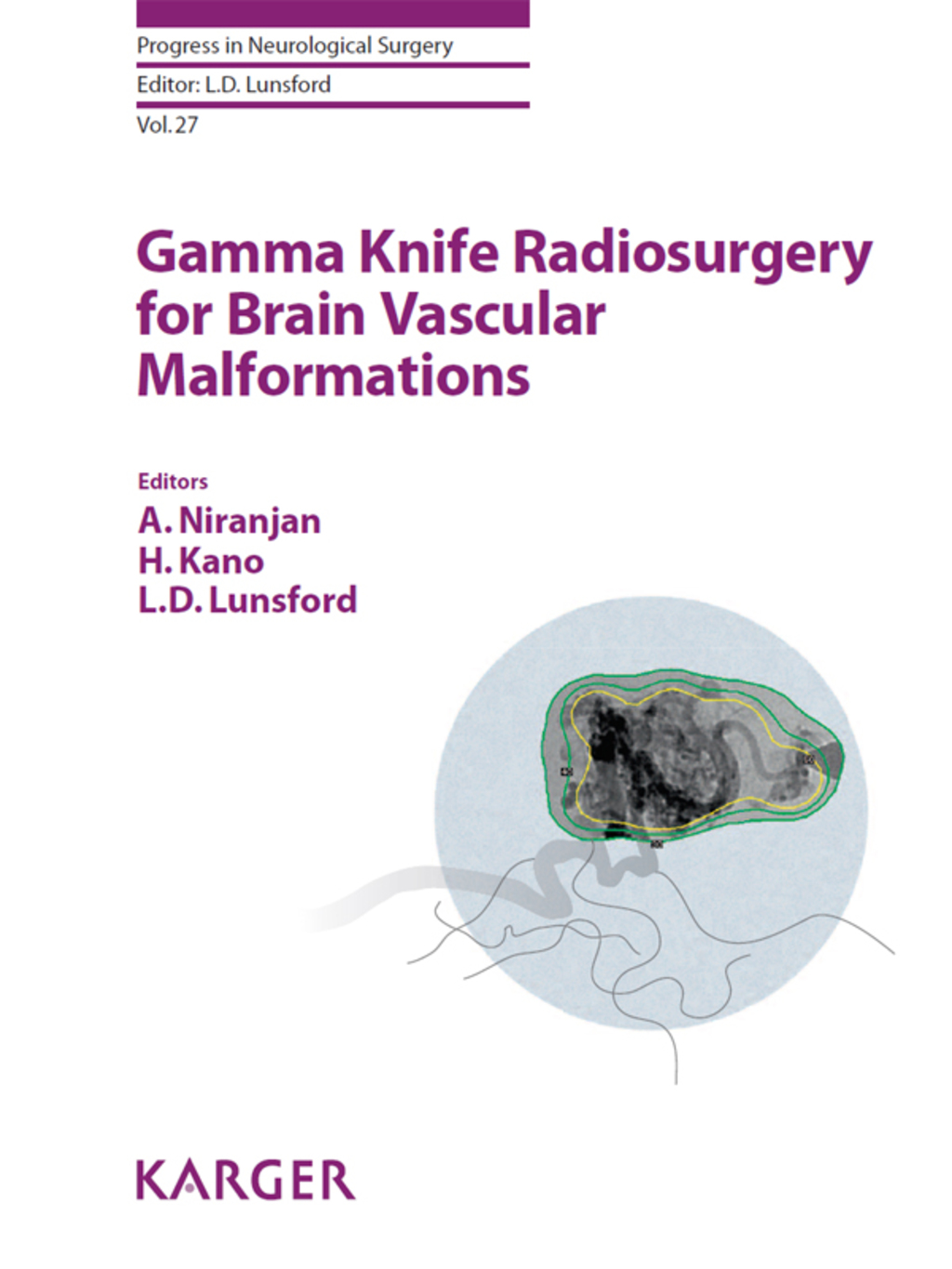 Gamma Knife Radiosurgery for Brain Vascular Malformations 1st Edition