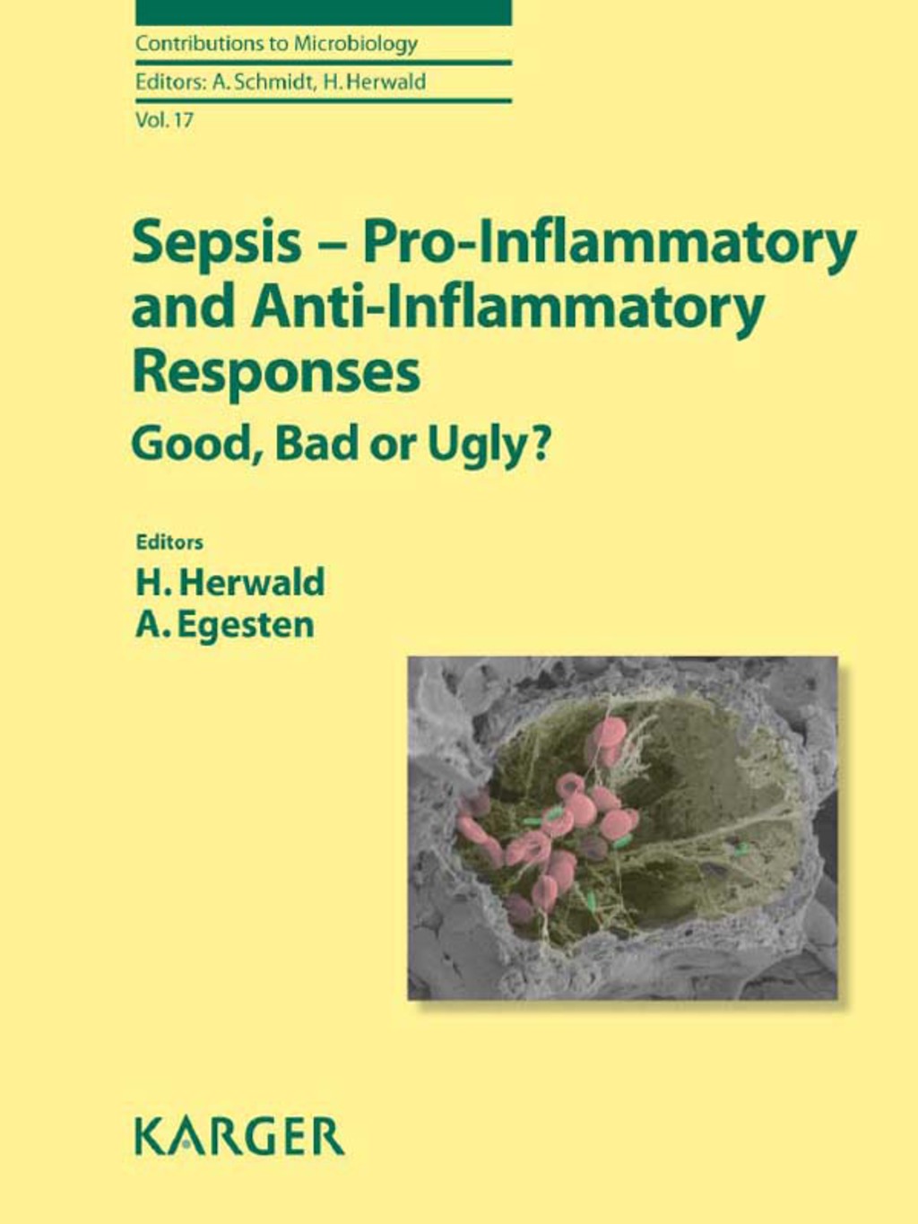 Sepsis - Pro-Inflammatory and Anti-Inflammatory Responses Good, Bad or Ugly? 1st Edition