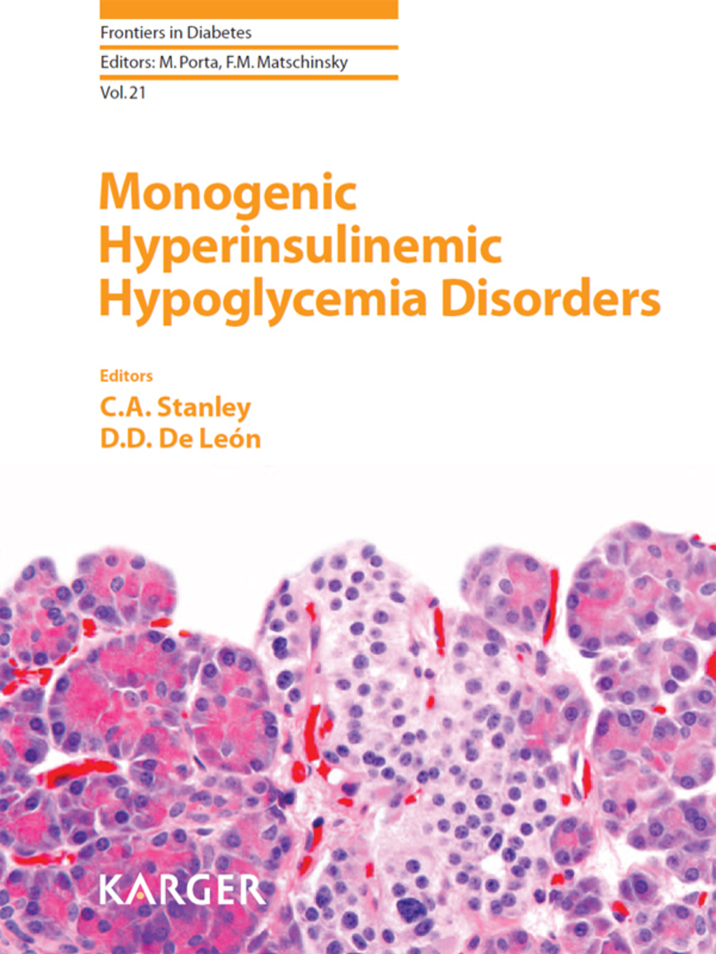 Monogenic Hyperinsulinemic Hypoglycemia Disorders 1st Edition