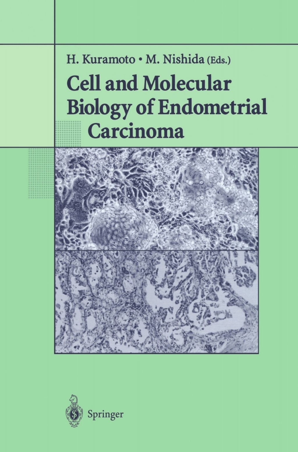 Cell and Molecular Biology of Endometrial Carcinoma 1st Edition