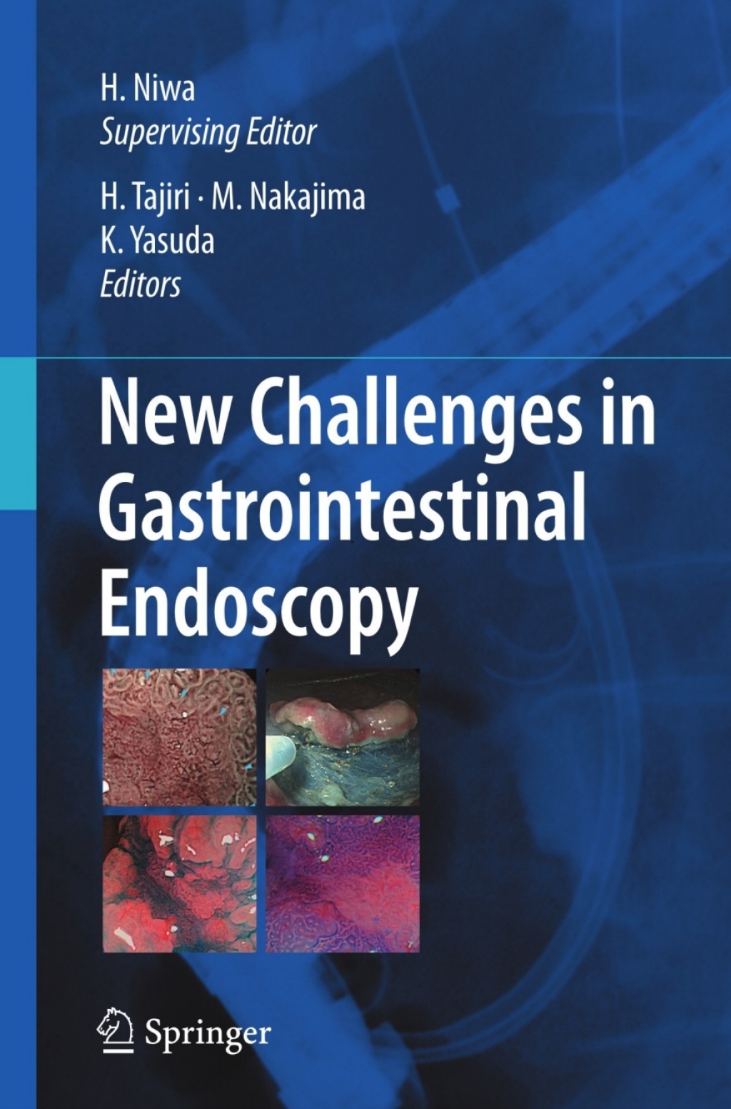 New Challenges in Gastrointestinal Endoscopy 