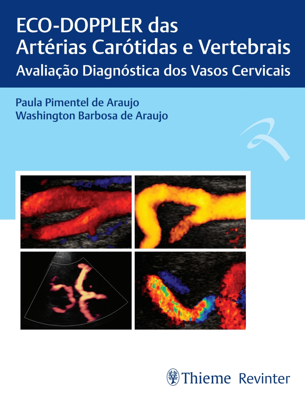 ECO-DOPPLER das ArtÃƒÂ©rias CarÃƒÂ³tidas e Vertebrais: AvaliaÃƒÂ§ÃƒÂ£o DiagnÃƒÂ³stica dos Vasos Cervicais 1st Edition